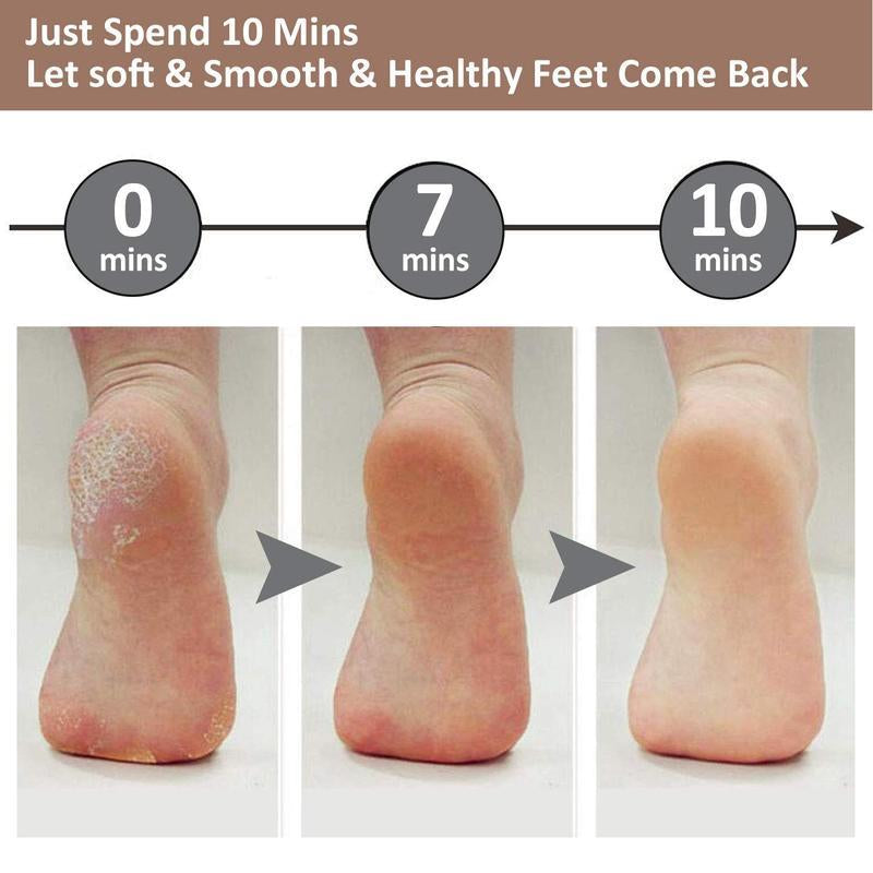 Electric Feet Callus Remover,Portable Electronic Foot File Pedicure Tools,Waterproof Foot Scrubber File,Pedi Foot Care for Dead,Hard Cracked Dry Skin Manicure Nail Nail Care Cutics Nail Art